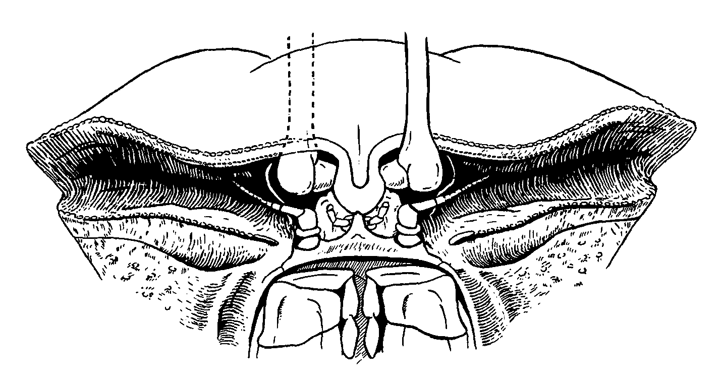 Uca forcipata: Crane (1975) image